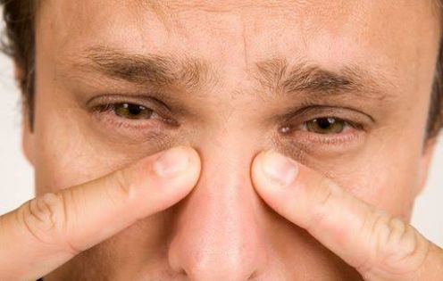 Mengenal Sinusitis Dan Pengobatannya | YesDok